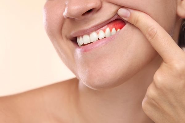Reasons To Choose Periodontics